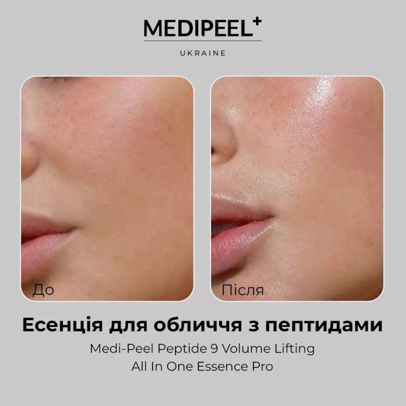 Інтенсивна киснева есенція на основі колагену та гіалуронової кислоти MEDI PEEL Peptide 9 Volume Lifting All In One Essence Pro, 100 мл