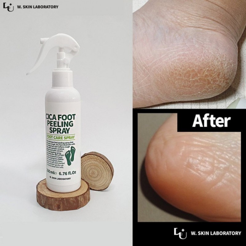 Спрей-пілінг для ніг W.SKIN LABORATORY Cica Foot Peeling Spray, 200 мл